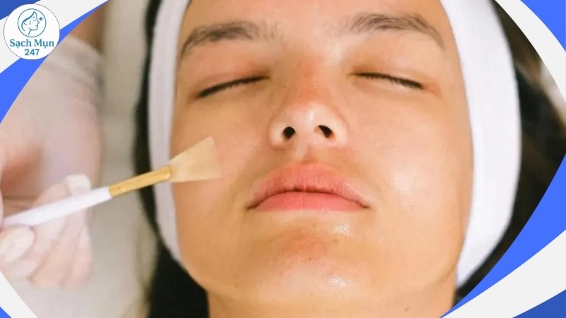 Chăm sóc ngay sau khi nặn mụn