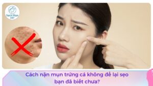 cách nặn mụn trứng cá không để lại sẹo