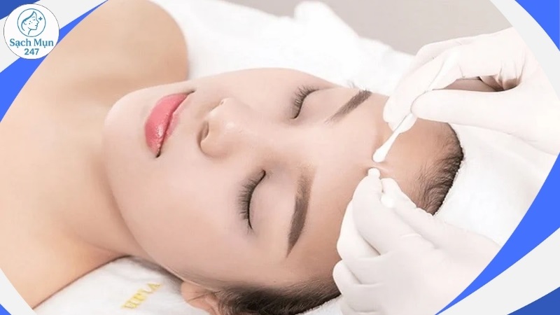 nặn mụn đúng kỹ thuật