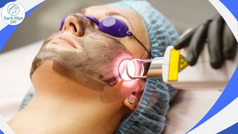 Điều trị mụn bằng công nghệ hiện đại