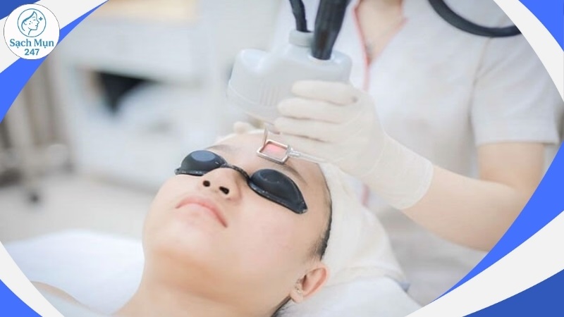 Điều trị mụn y khoa