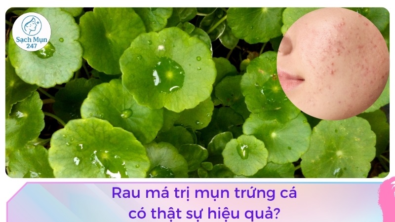 rau má trị mụn trứng cá