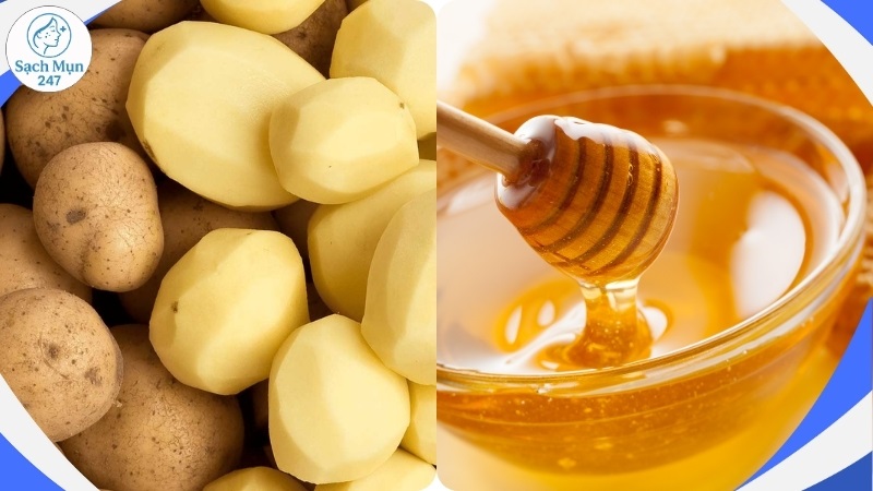 Khoai tây kết hợp mật ong trị mụn