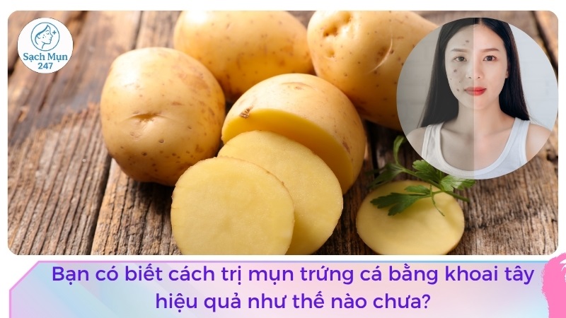 trị mụn trứng cá bằng khoai tây