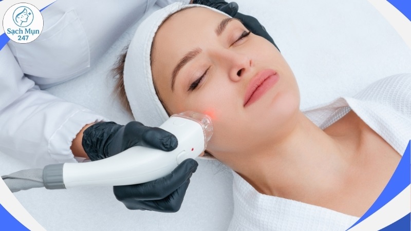 Liệu pháp ánh sáng trị mụn