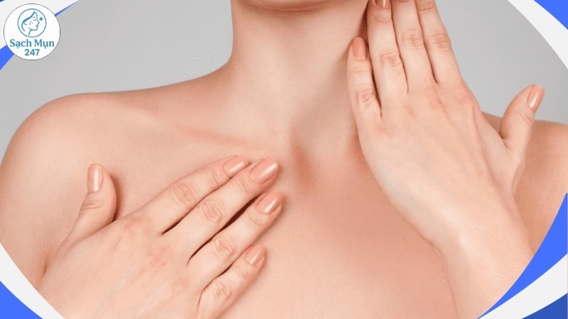 cách trị mụn trứng cá ở cổ