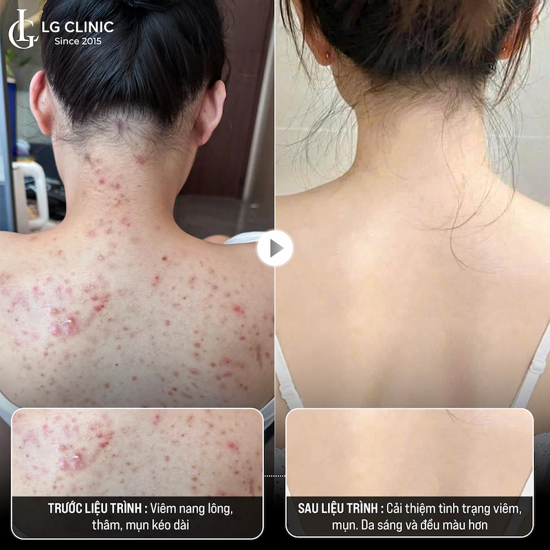 Khách hàng của LG Clinic